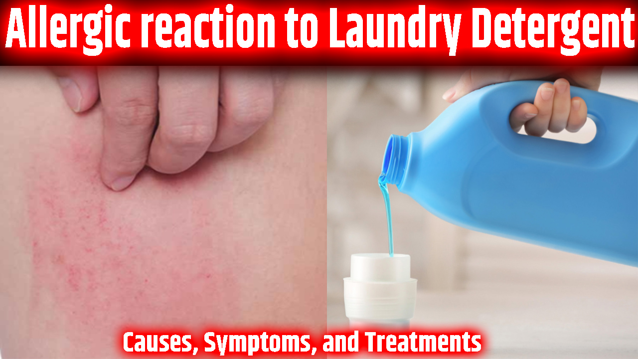 Allergic Reaction To Laundry Detergent Causes Symptoms And Treatments