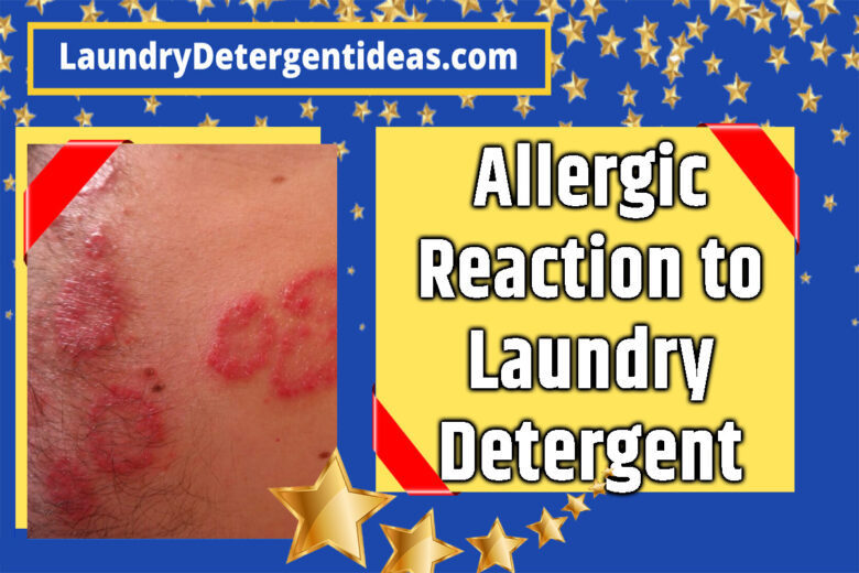 How Long Does an Allergic Reaction to Laundry Detergent Last