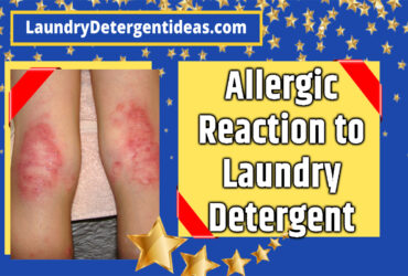 Allergic reaction to laundry detergent