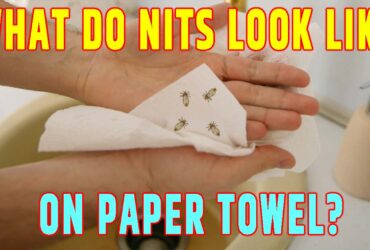 What Do Nits Look Like on Paper Towel